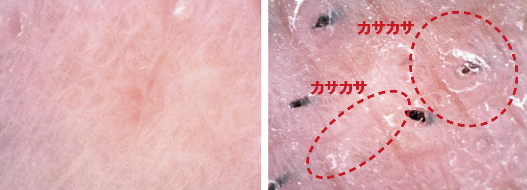 シェービング剤の使用を習慣とする男性