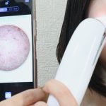 スマホ連動 毛穴クリーナーはスマホアプリで毛穴を見ることができる