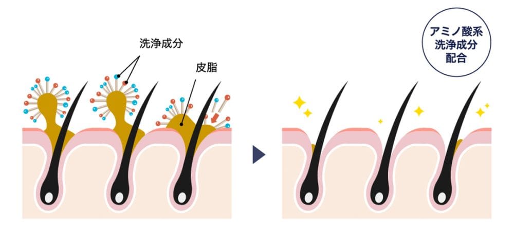 W皮脂溶解成分