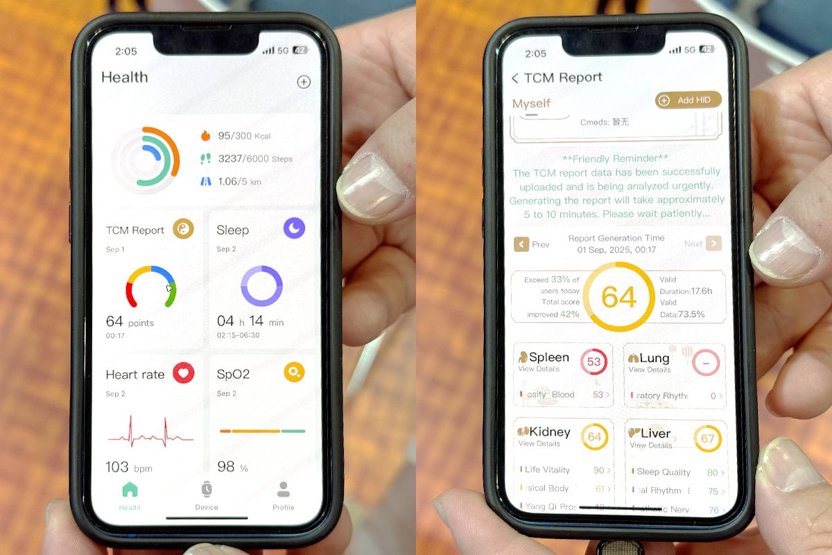 「脾臓」「肺」「腎臓」「肝臓」などと、内臓ごとにスコアがつけられていた