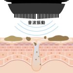 直径0.7mmの極細 毛と毎分約11,000 回の音波振動