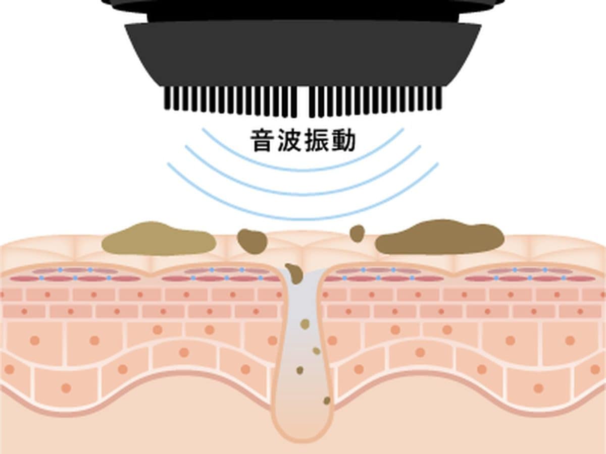 直径0.7mmの極細 毛と毎分約11,000 回の音波振動