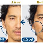 ニードルリフトブラシを使った幸太さんのビフォーアフター