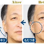 リフトライザーを使ったライター岡藤さんのビフォーアフター