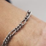 チタンは生体適合性が高く、外す必要がない