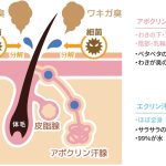 わきがと多汗の違い