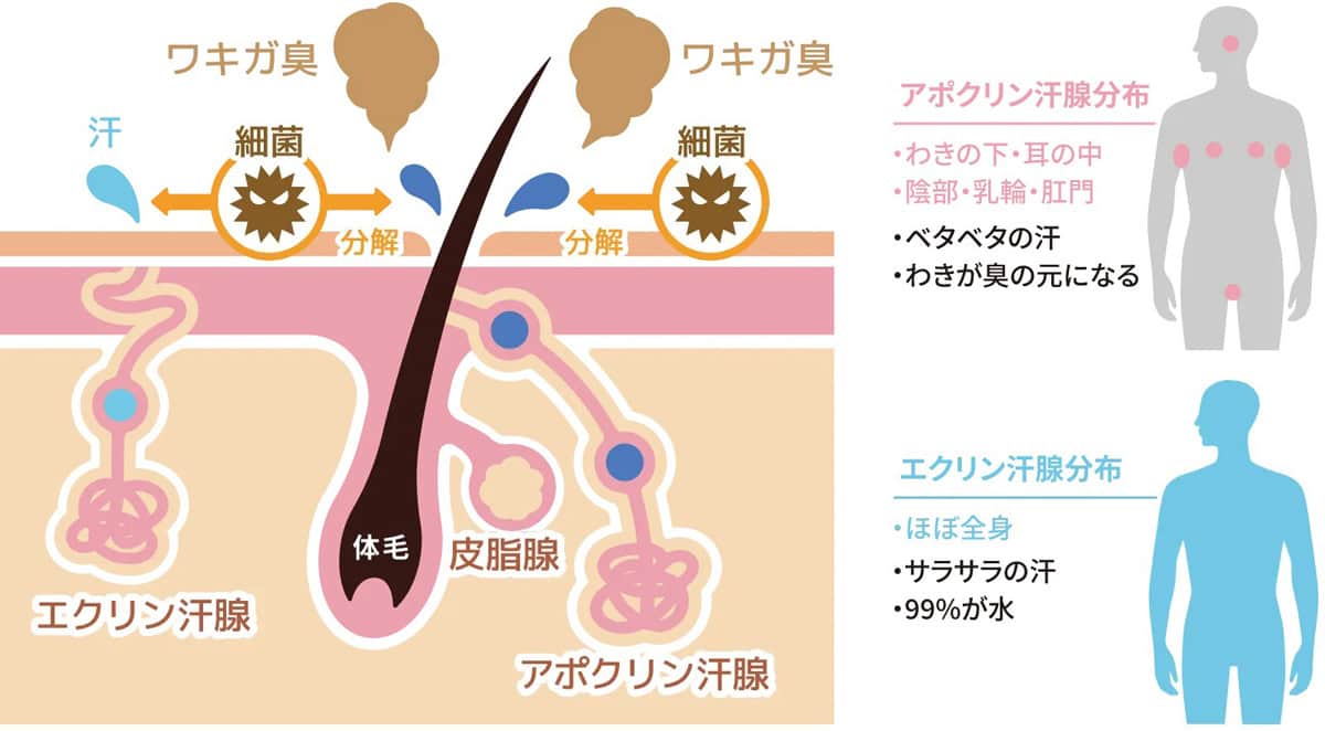 わきがと多汗の違い