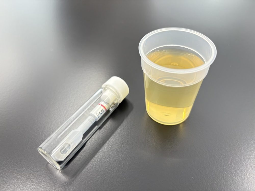 舌の上にある味覚の受容体を模倣した味覚センサー装置を使えば、さまざまな味物質を「味」として感じることが可能